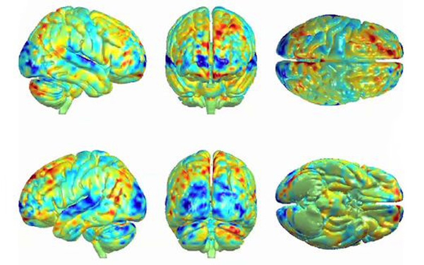 Brain response to music